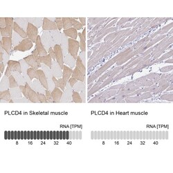 PLCD4 Antibody, Novus Biologicals:Antibodies:Primary Antibodies
